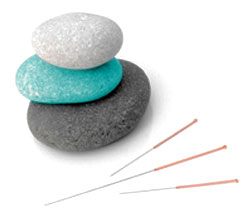 stones and acupuncture needles